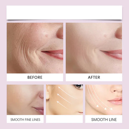 Kindoria Invisible Face Lift Tape